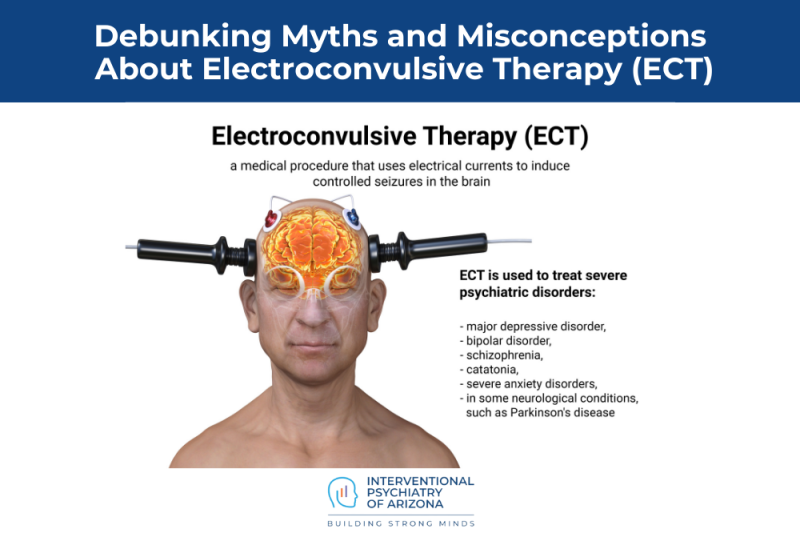 Debunking Myths and Misconceptions About Electroconvulsive Therapy (ECT)