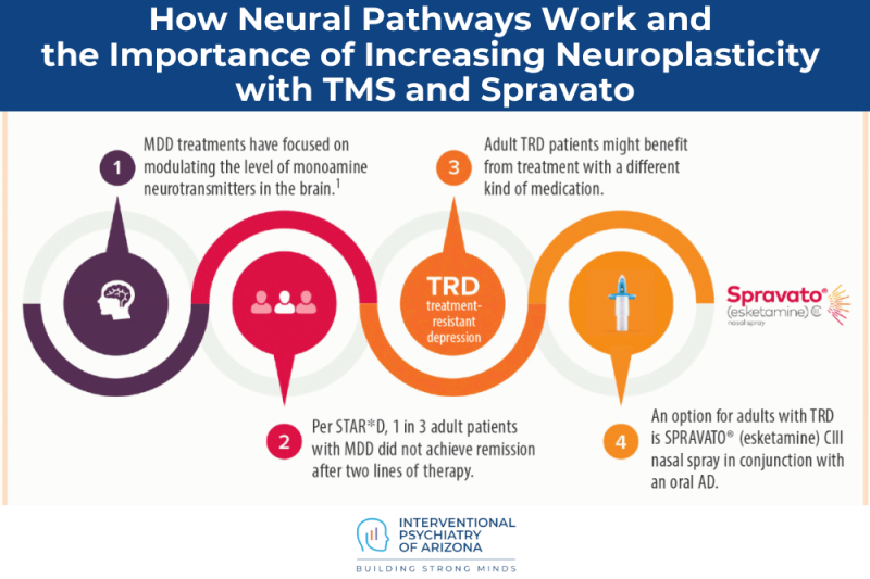 How Neural Pathways Work and the Importance of Increasing Neuroplasticity with TMS and Spravato