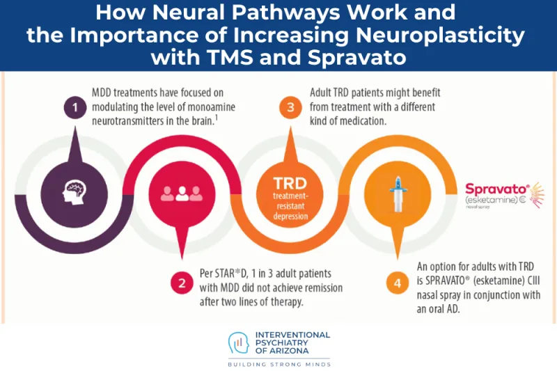 How Neural Pathways Work and the Importance of Increasing Neuroplasticity with TMS and Spravato