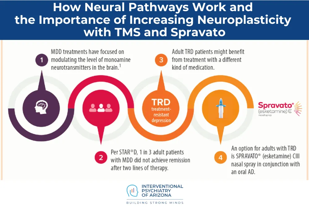 How Neural Pathways Work and the Importance of Increasing Neuroplasticity with TMS and Spravato