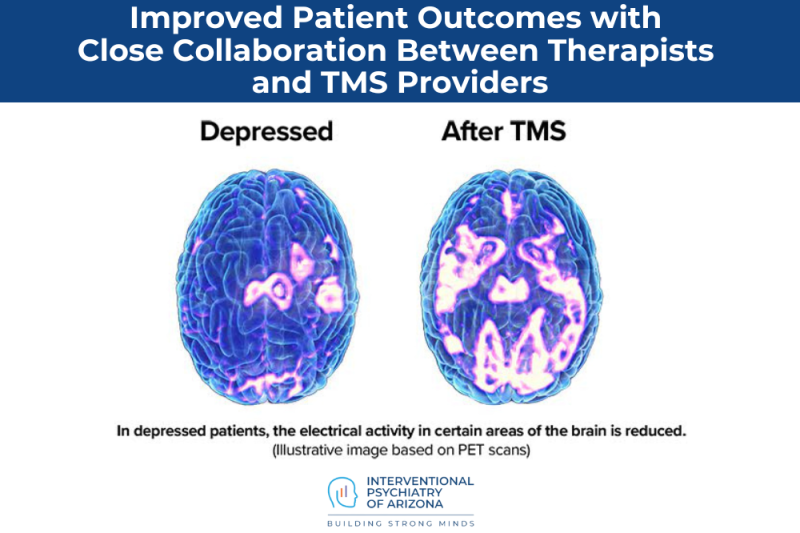 Improved Patient Outcomes with Close Collaboration Between Therapists and TMS Providers